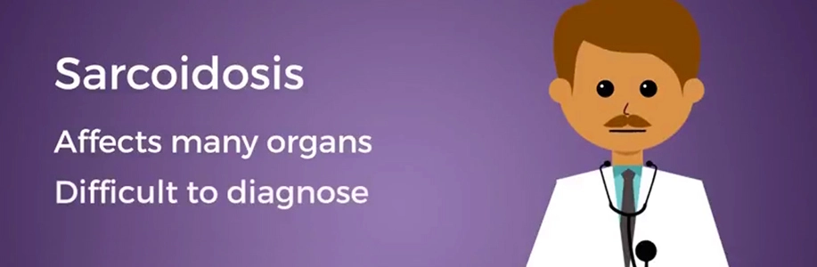 Illustration of male doctor with text Sarcoidosis, affects many organs, difficult to diagnose